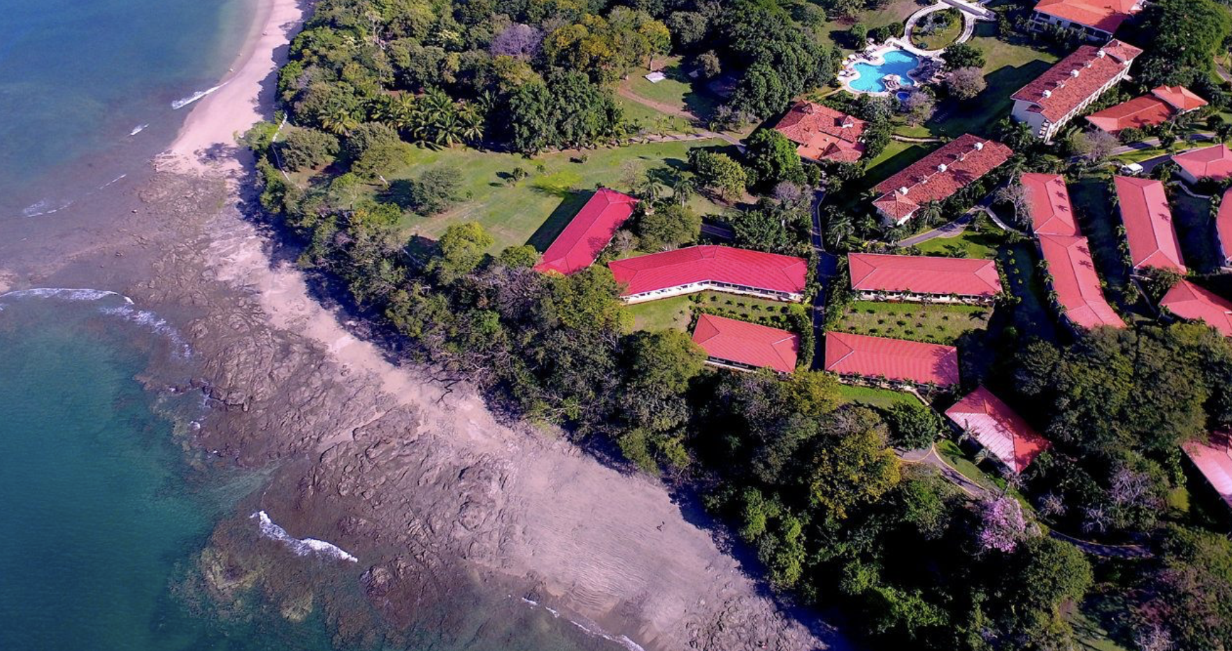 hotel and beach
